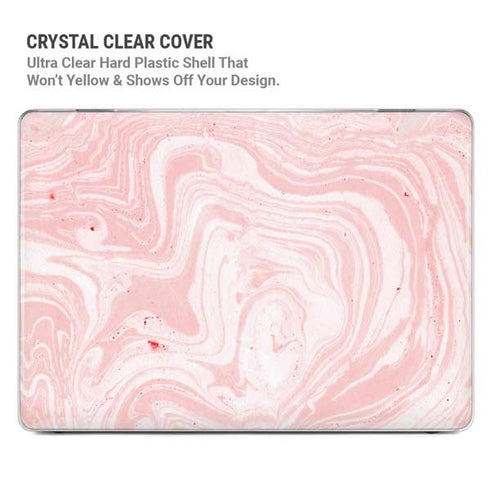 Pink Marbling MacBook Pro 14in (2021-24) Case plus Skin